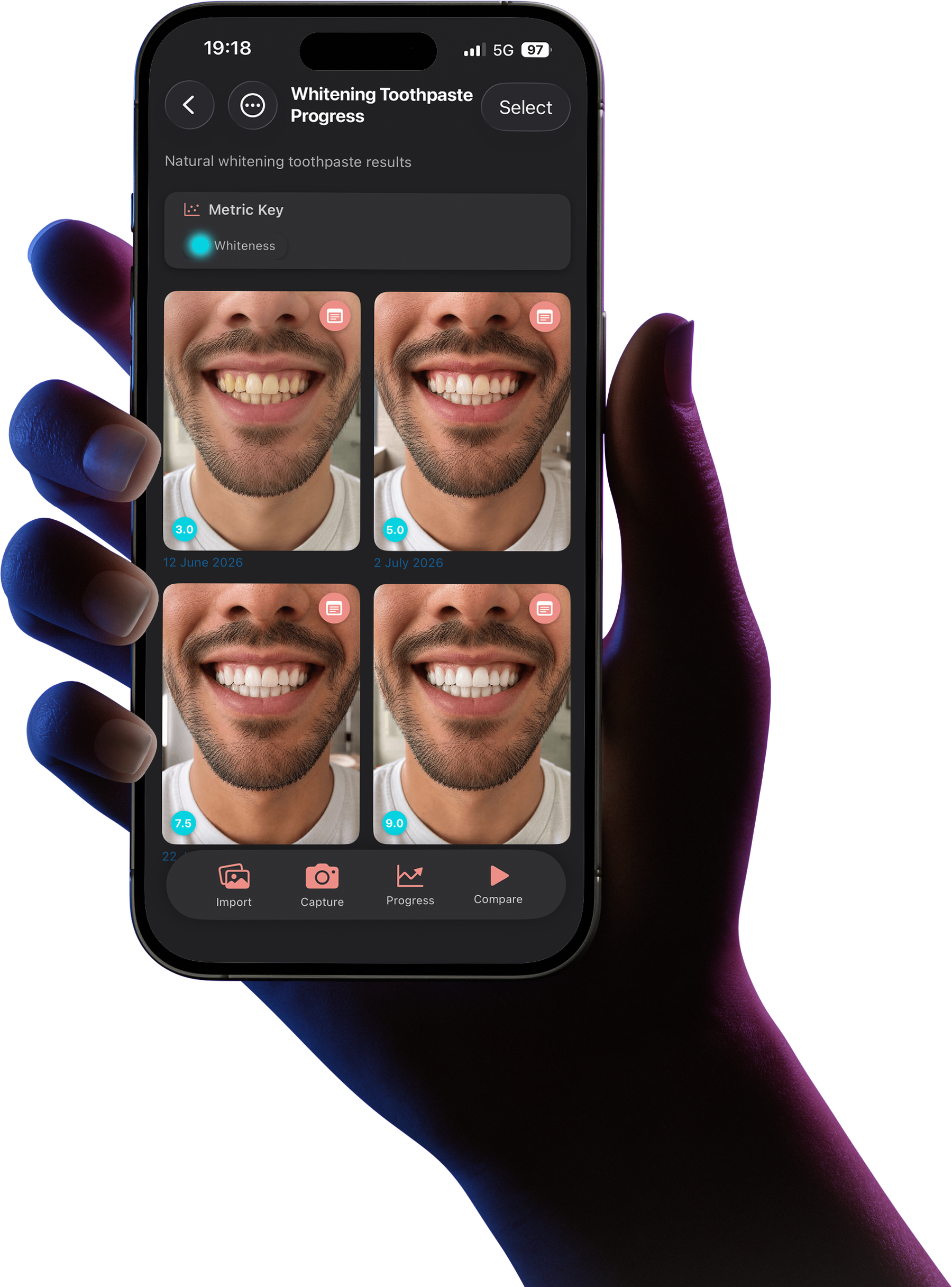 An iPhone held in one hand showing a WTNS record: four dated photos of a whitening journey, each tagged with its whiteness score
